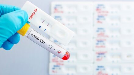 Ακόμα ένας κορυφαίος πολιτικός βρέθηκε θετικός σε κορωνοϊό